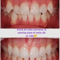 Ilustración dental