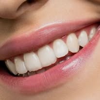 Caries dental
